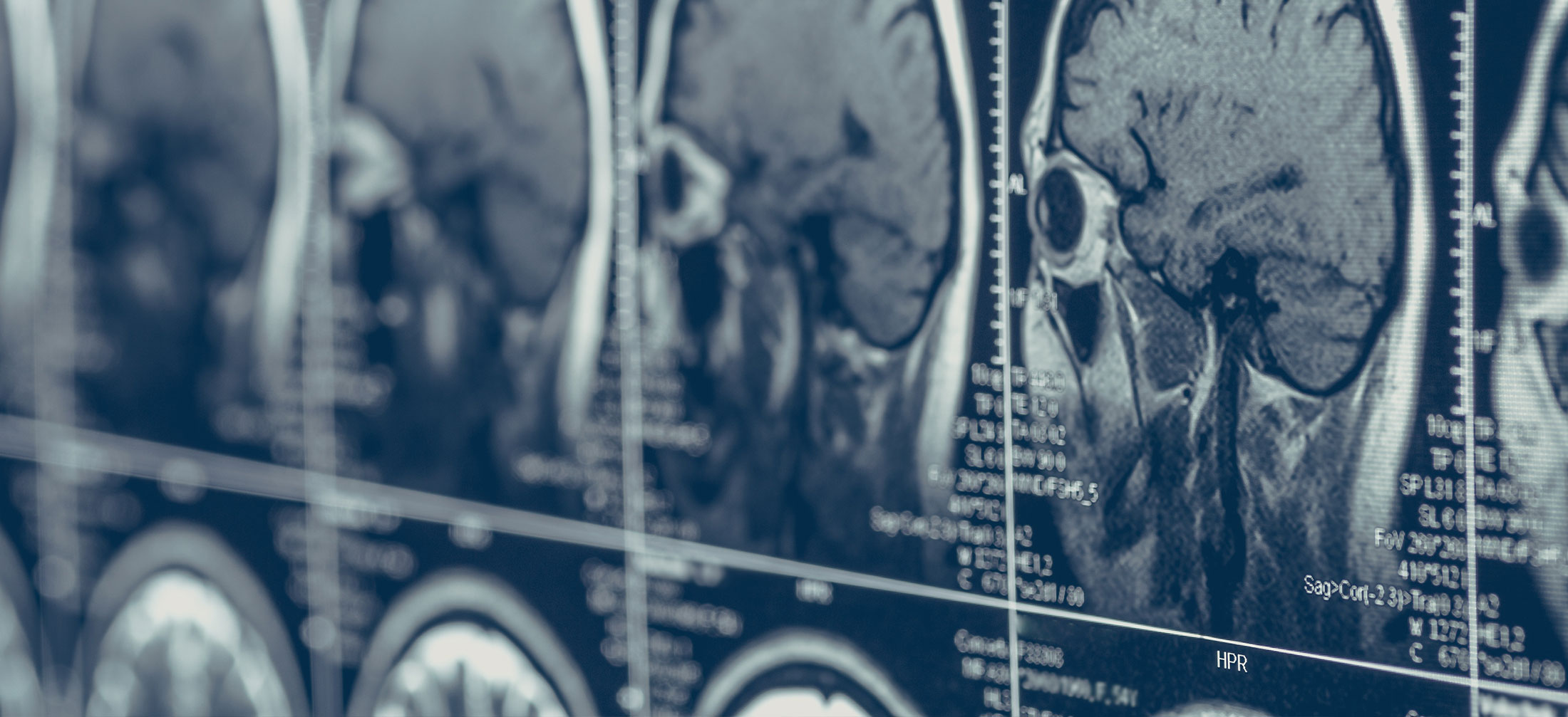 Concussion.blog